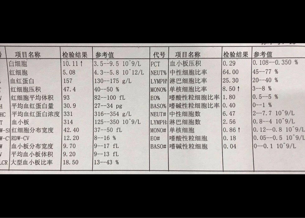 192224a22w9wq1vd4vk91n.jpg