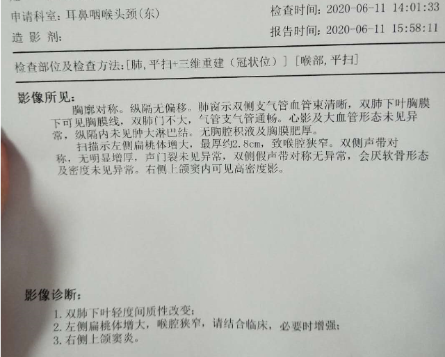 CT报告