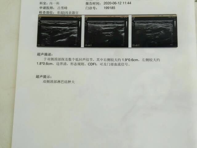 212717f919o11cdb129seg.jpg