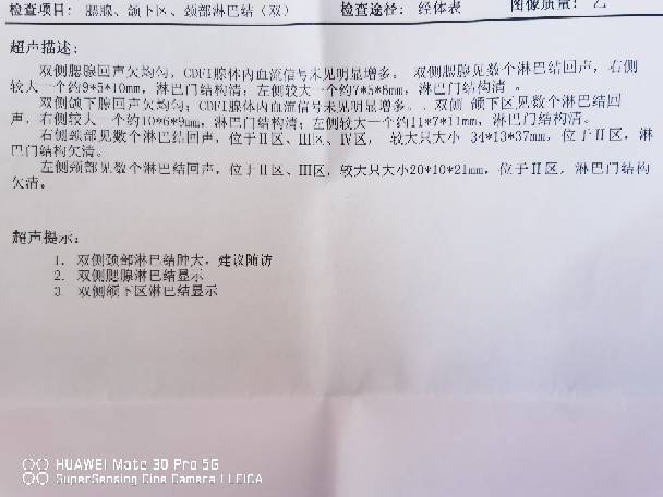 095009ek8wcpzi43ic38ci.jpg