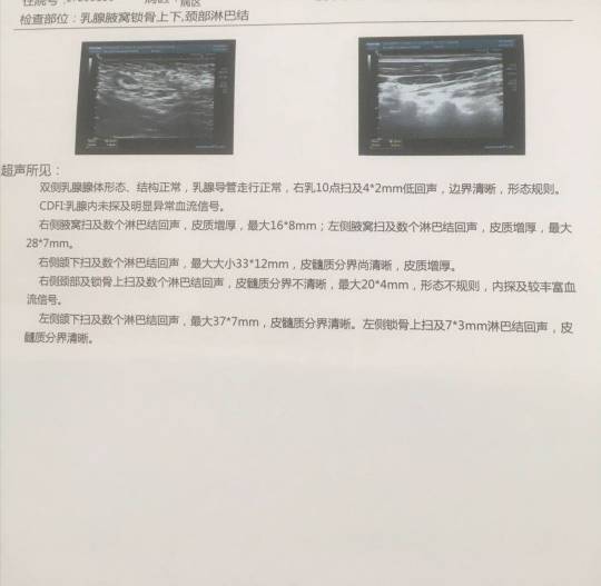 160135xe9dlxkgxlkdklu9.jpg