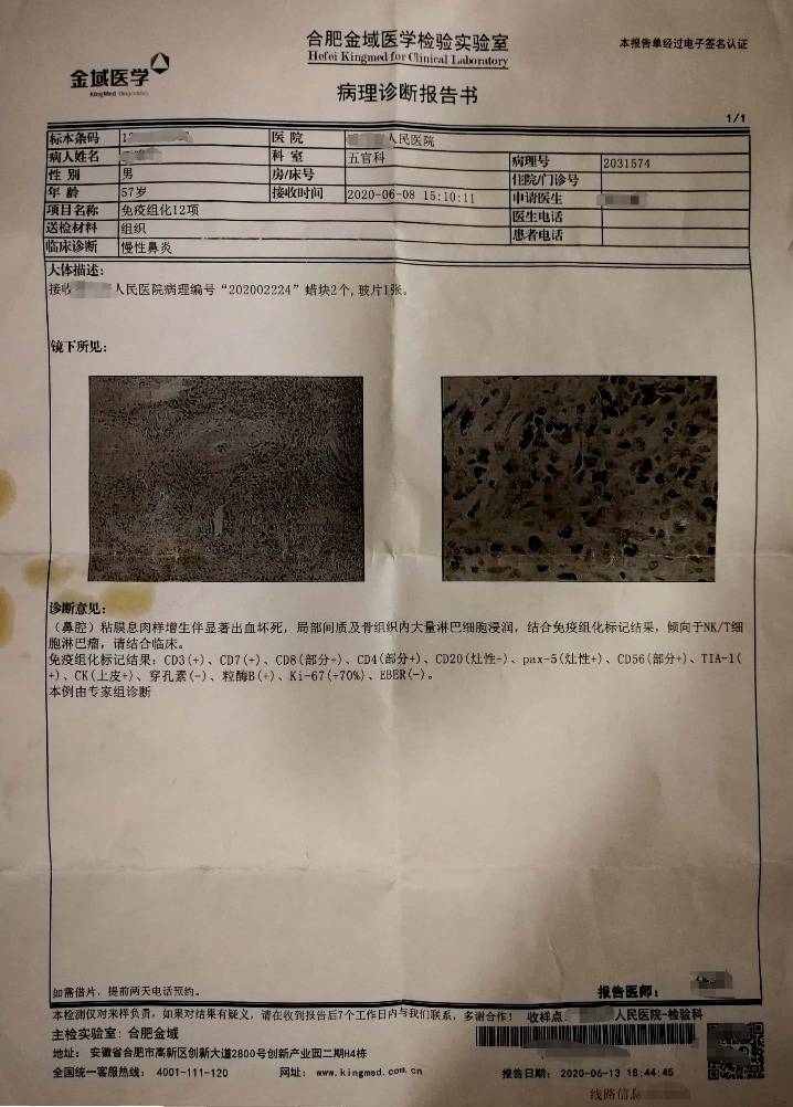 221501nvms3r46m333iwww.jpg