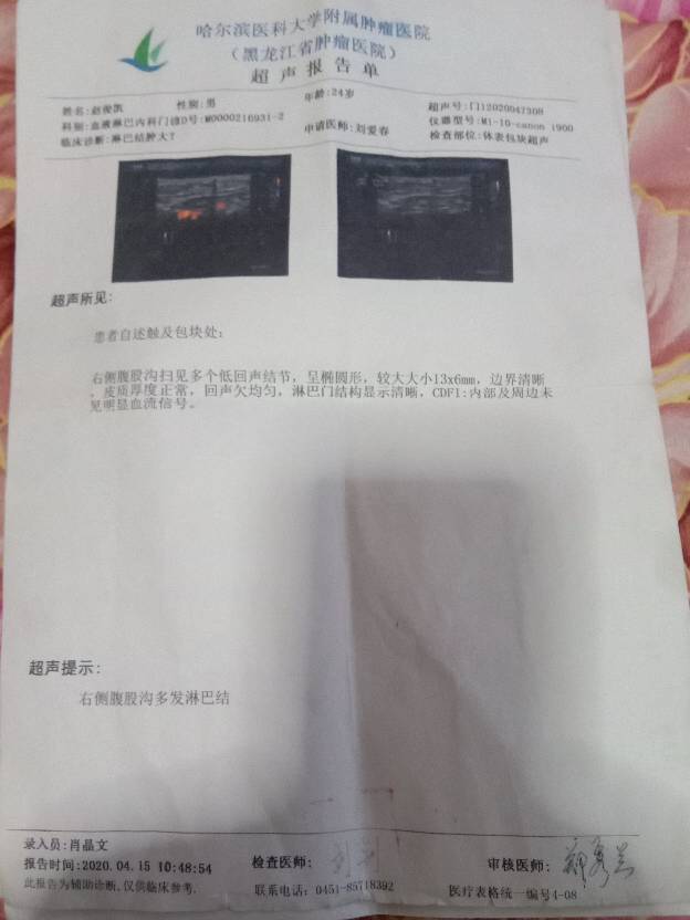 215016mereex21s8ssz14i.jpg