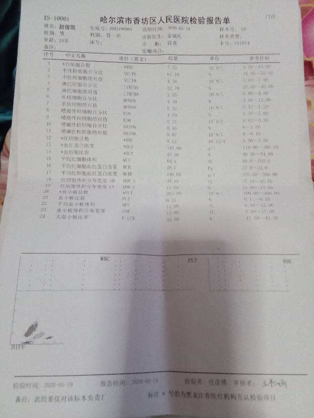215018x3k6rt7igkiz1w5r.jpg