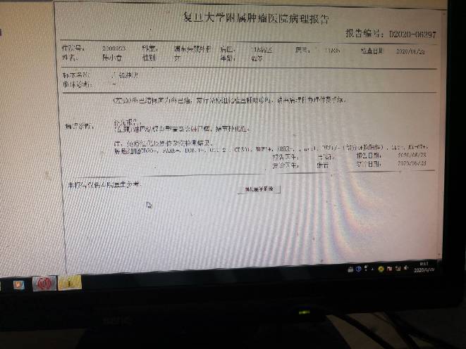 093242zd9pvcootodd4ldm.jpg