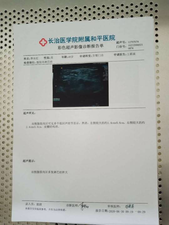 134814r2v8yuu9m1vur2hm.jpg