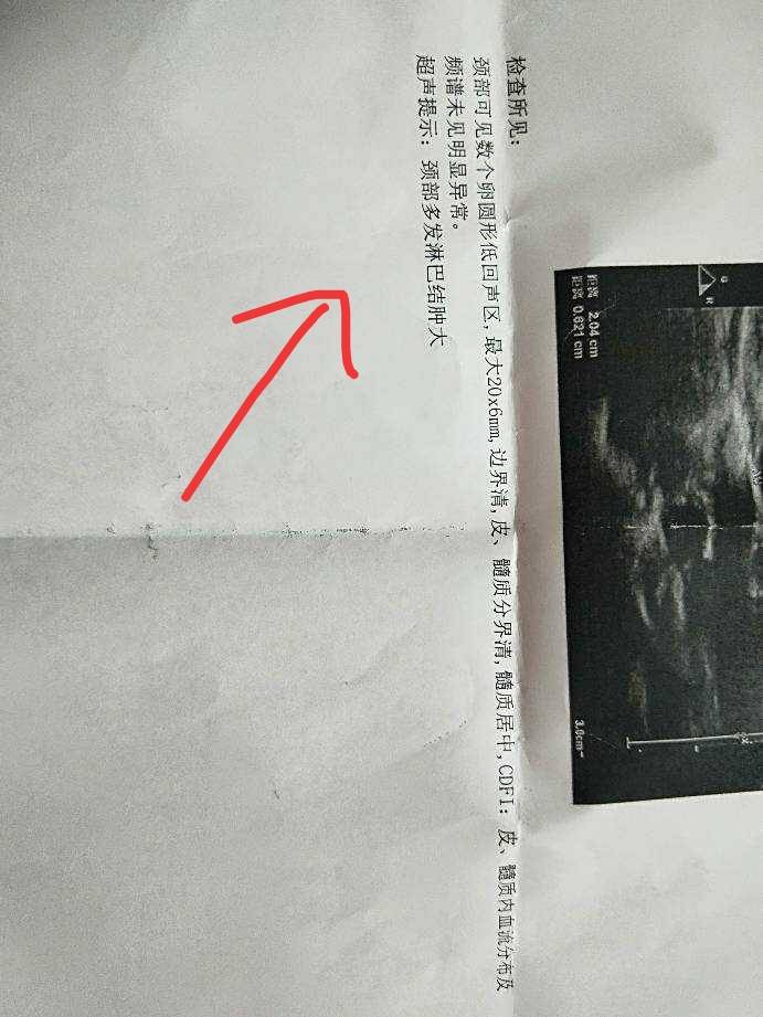 221217tj6wusaj7iaasi38.jpg
