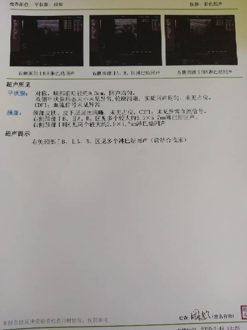 142507lbgbql0oqjoqy5po.jpg