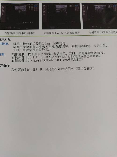 142600gamroqdp51m8tkt1.jpg