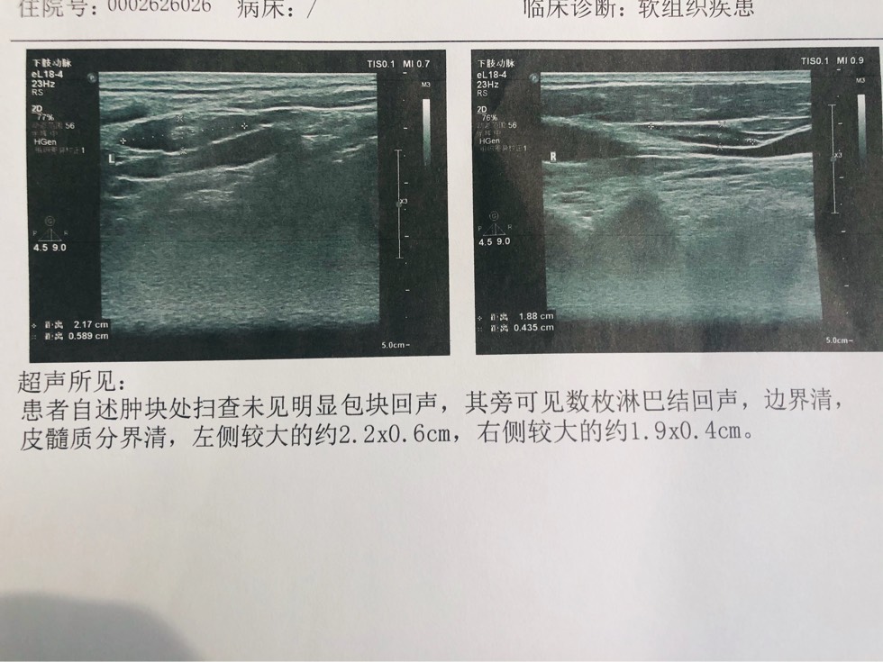 155027udb6hz7dokffh57e.jpg