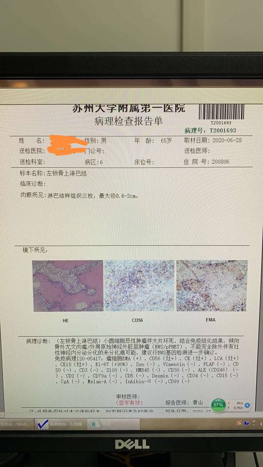 153128zyv8ya8880k4myry.jpg