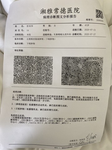 170704uc3e03cy6xvuyui0.jpg