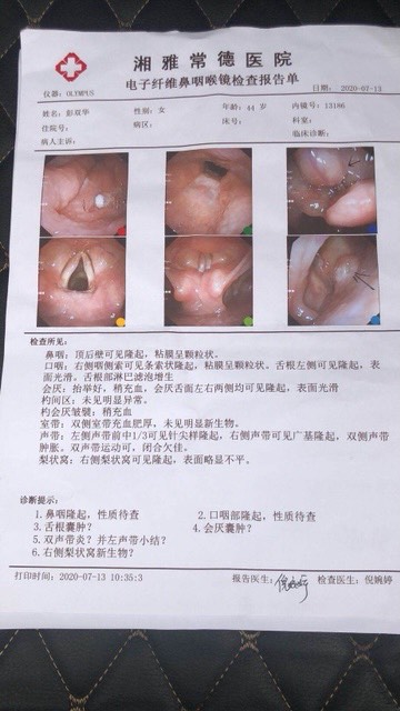 170708lfmi1i5c0451rxhb.jpg
