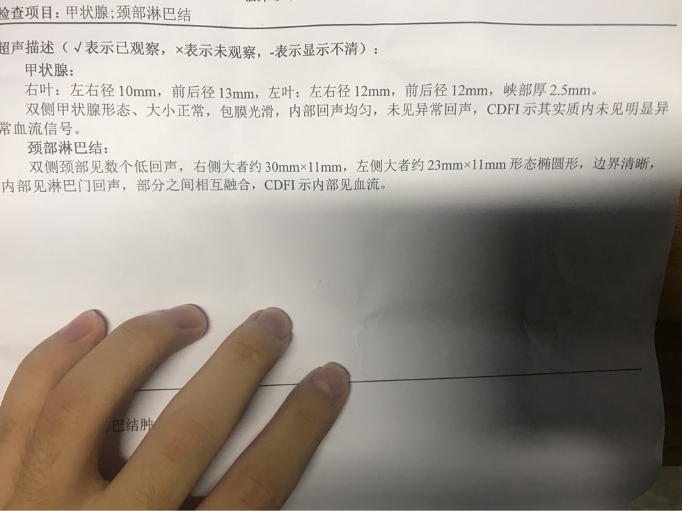 181355l3rzm4wm280x7642.jpg