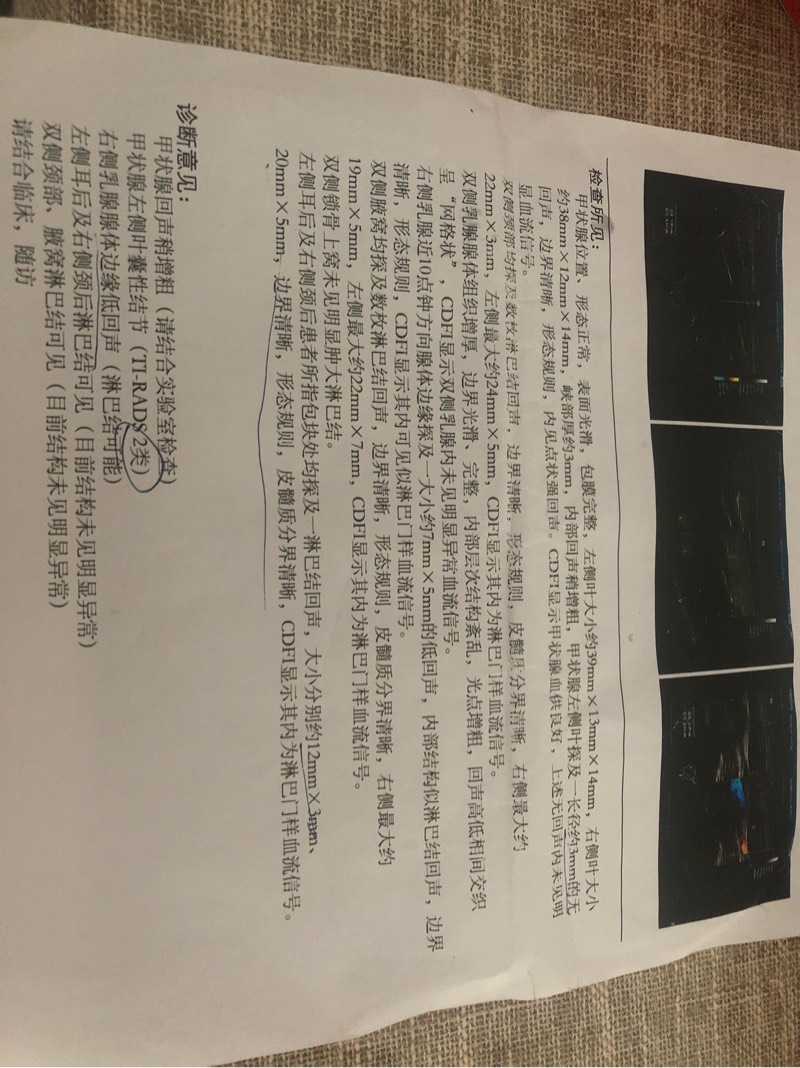 125150npuh0cczuoohzh3c.jpg