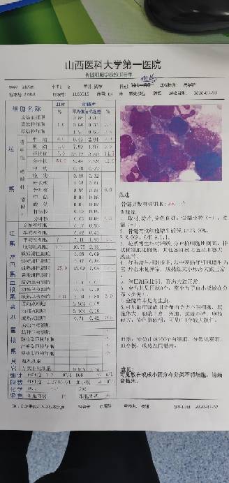 152614ozubu8ed3t3zudwf.jpg