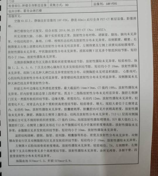 162517cdk7iolbisd79klv.jpg