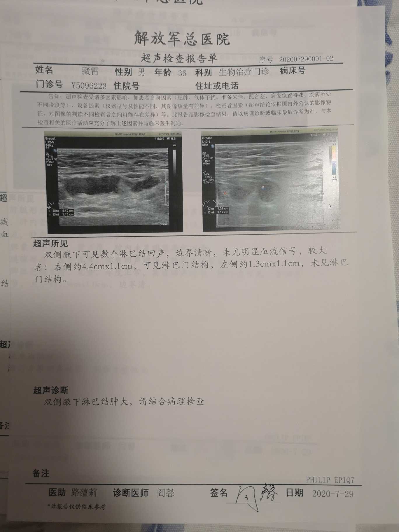 103533kt6v446ns4i4svcp.jpg