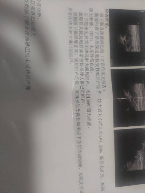 225556cscy9sysrsf4fwia.jpg