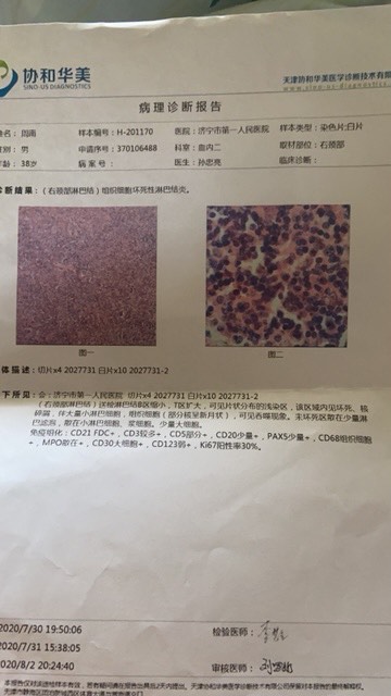 094016lks58bkjbeyusm82.jpg