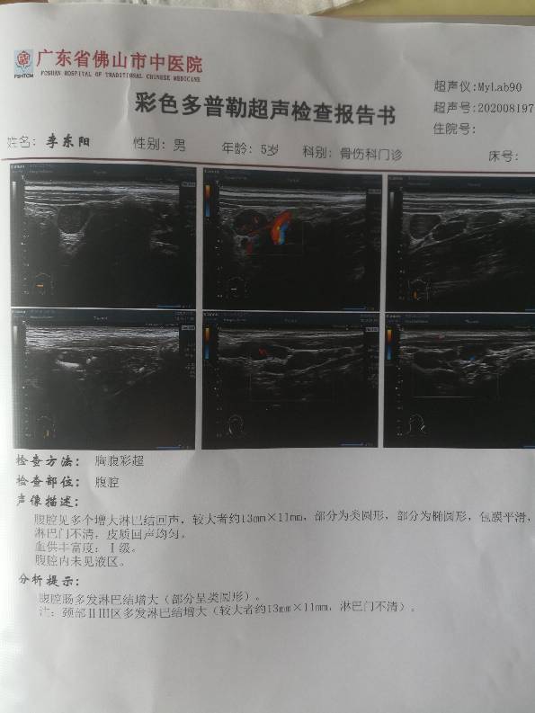 132647pdde2j5dgucz59um.jpg