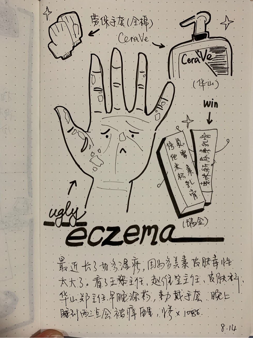 092759dy173hz4evcnueon.jpg
