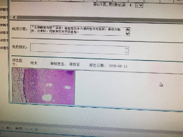 094353m5op7z7hsc0s5ige.jpg