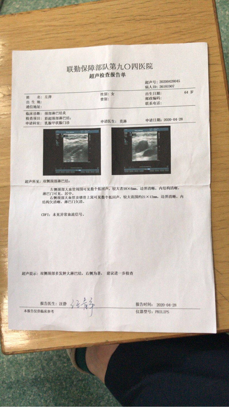 174204p44e0375lkokcqp5.jpg
