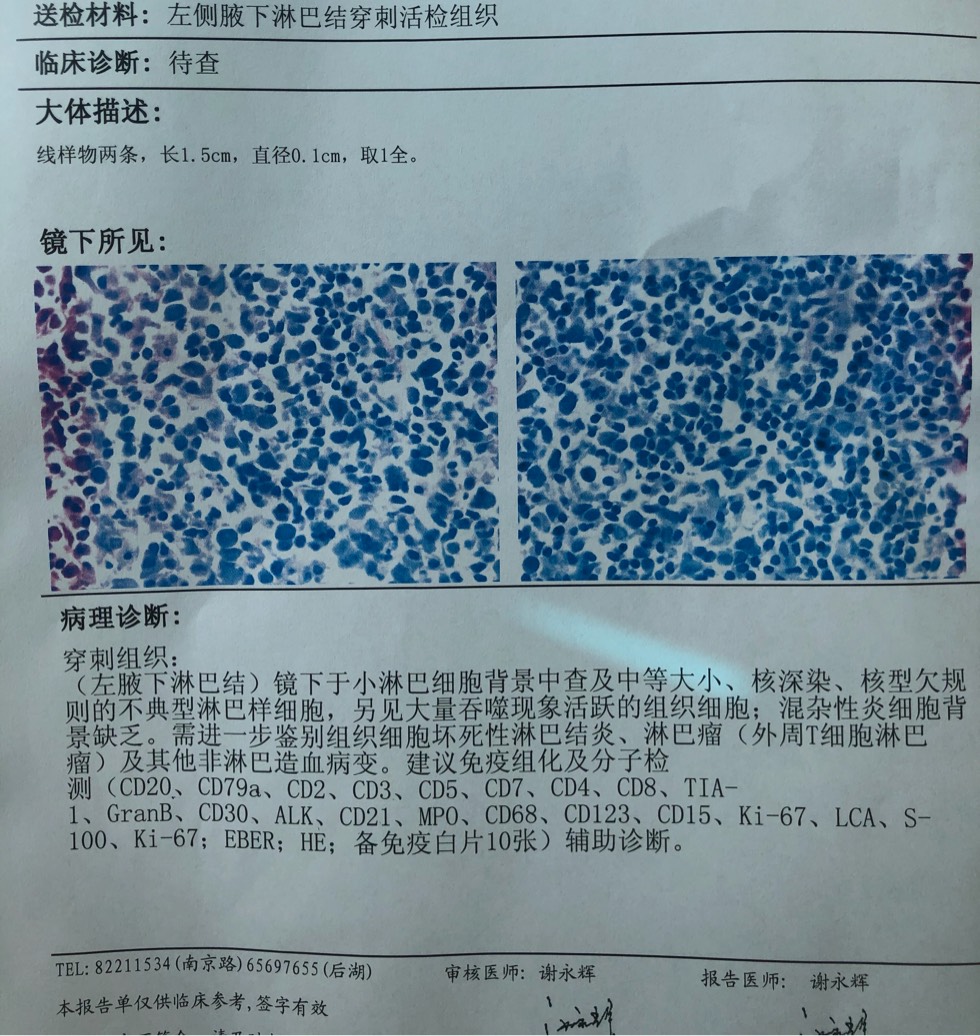 114856chy2sluso27snv9u.jpg