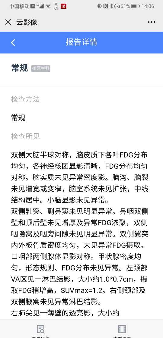 140935tfo1ms9m5vmx65la.jpg