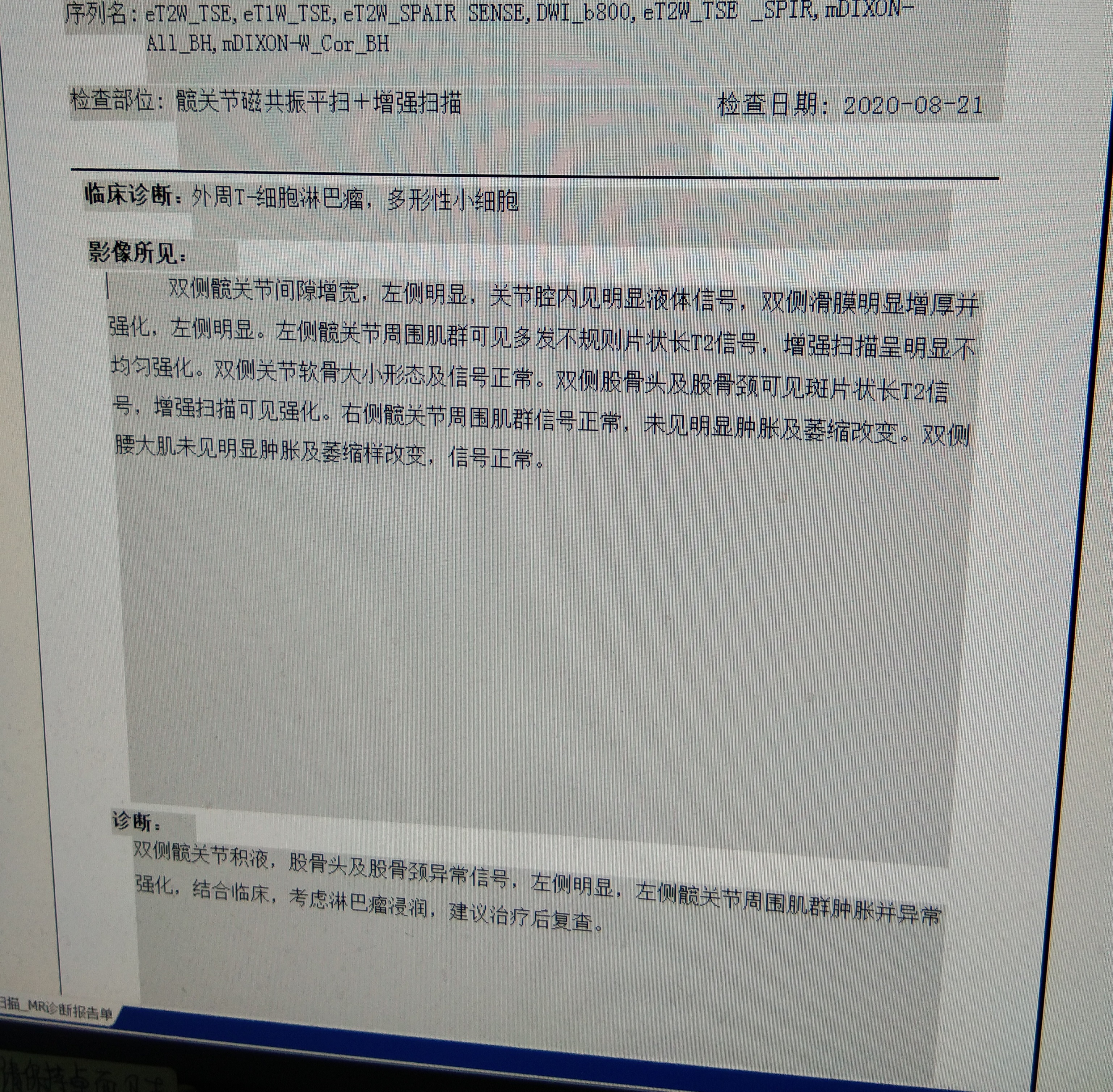 髋关节MRI报告.jpg
