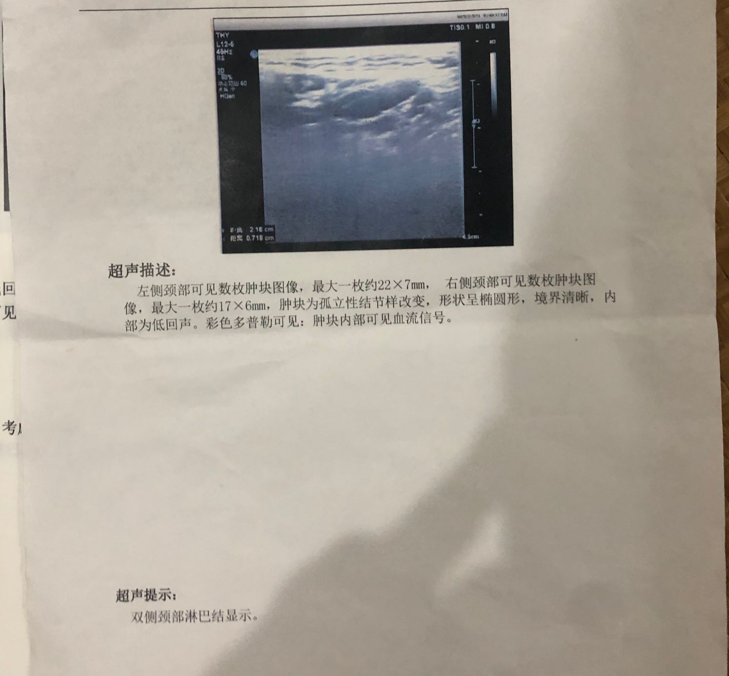 141118uks0wss7n840pkg6.jpeg