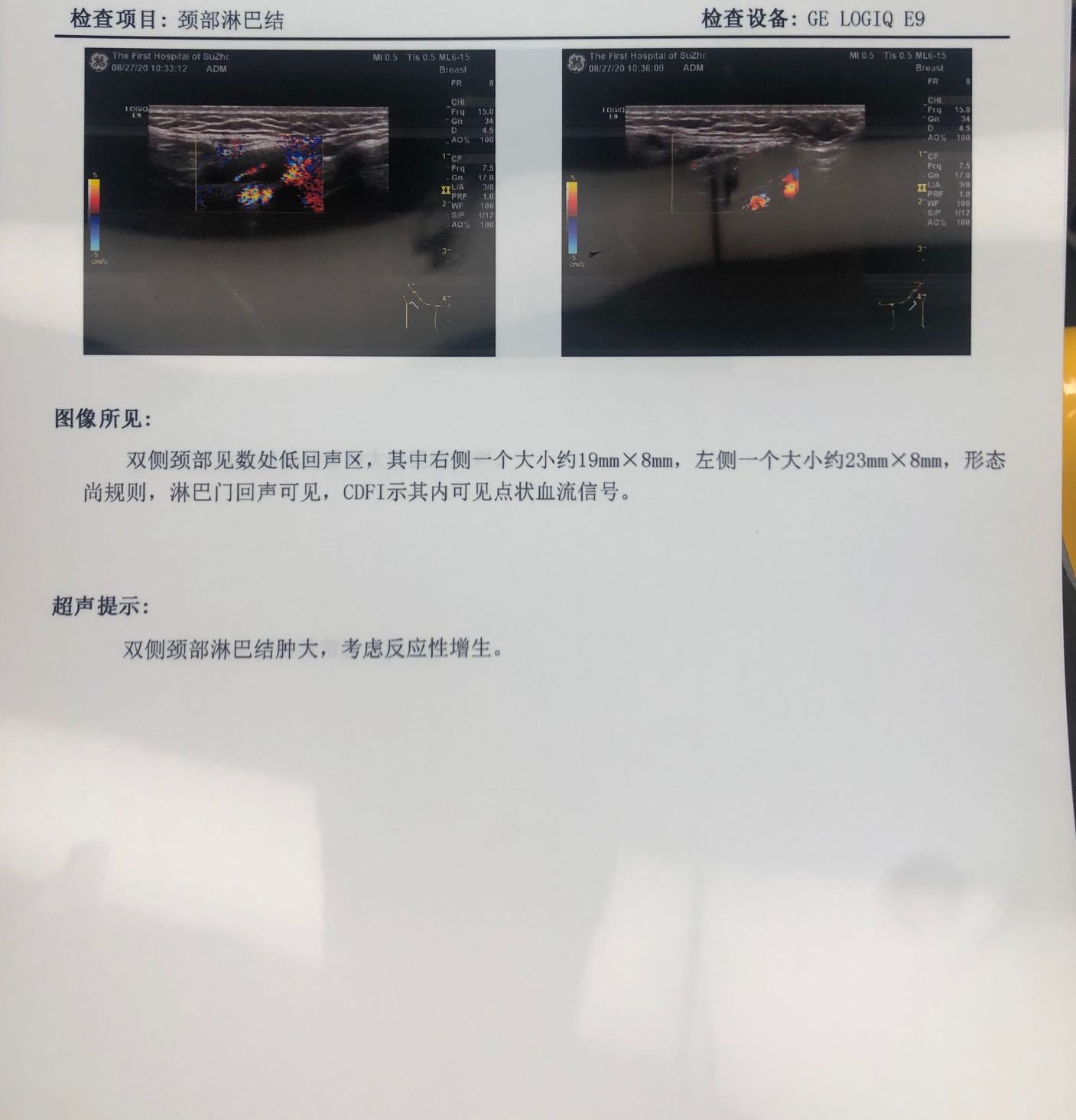 141119coji5bxrwwmht40l.jpeg