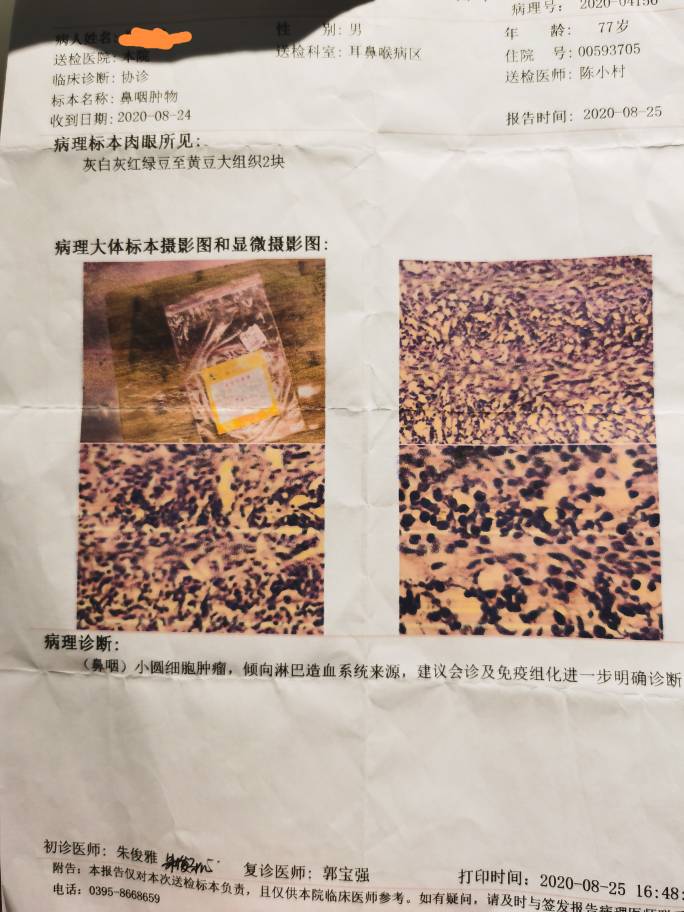 150736vwyupbudj65g8zwp.jpg