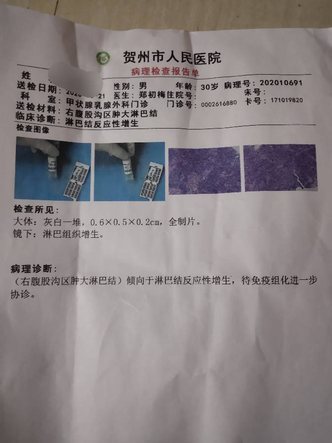 124641err4wjc9jc98ze4q.jpg