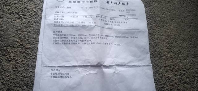 182110ko8jbo9yz9bosxdb.jpg