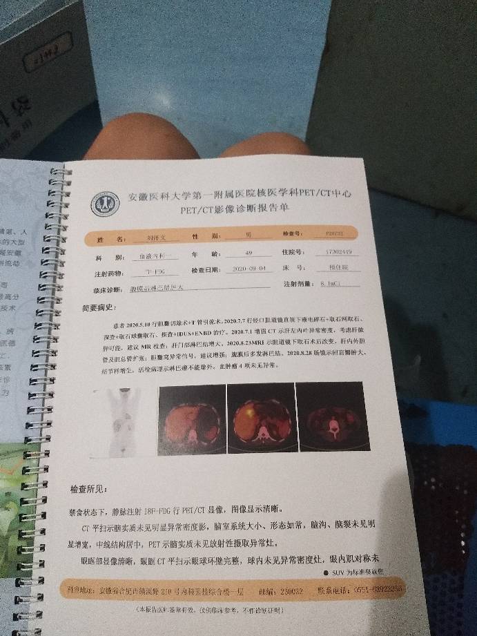 144225dpkm3jrt5kztwxjj.jpg