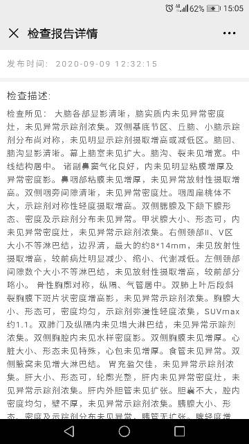 150609ow6xw83393zf6ekd.png