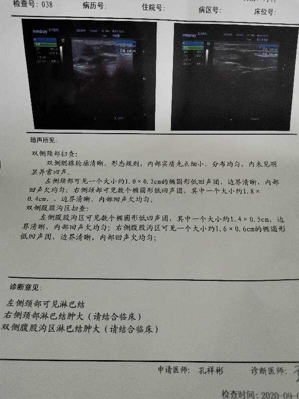 211704wkki9goojk5v655j.jpg