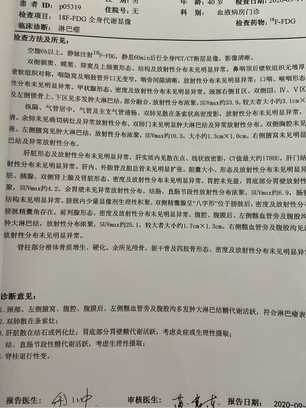 155027mt9mz6ttw6n8nn85.jpg