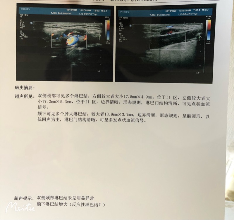 182727fpr7e9fp9mzfdsz9.jpg
