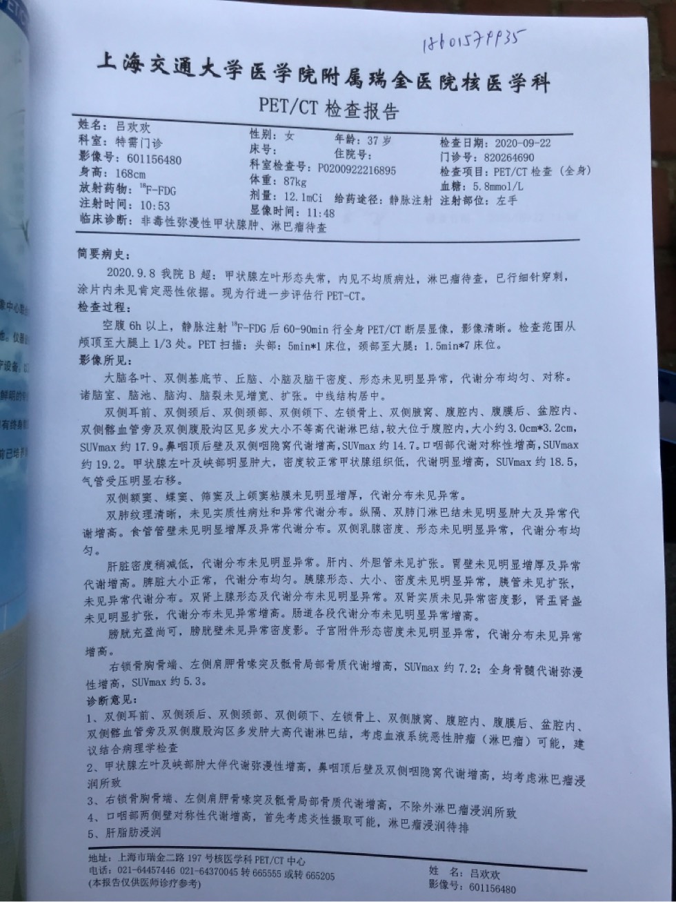 160626n2a5151spl1tnwnq.jpg