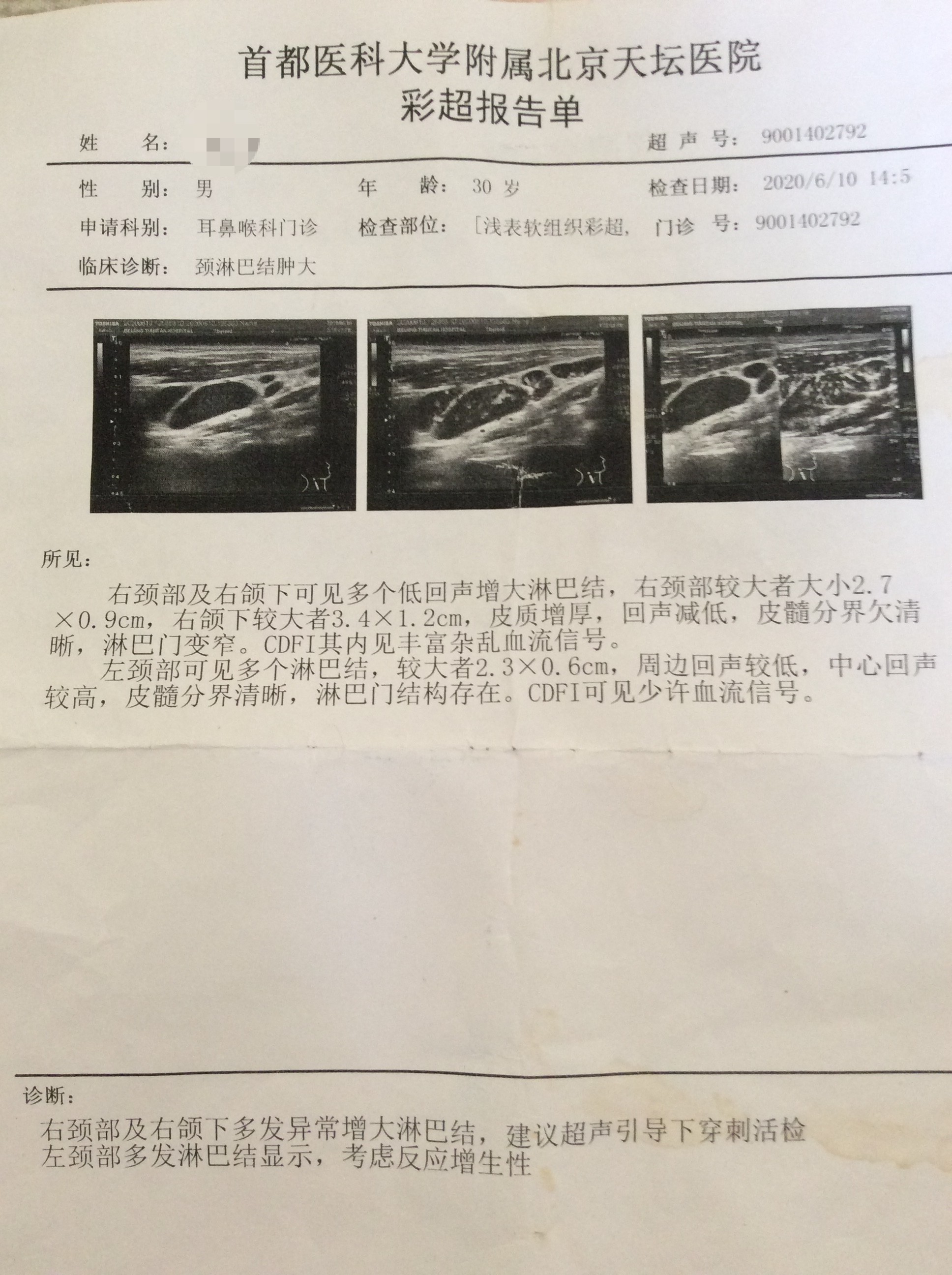 20200610超声