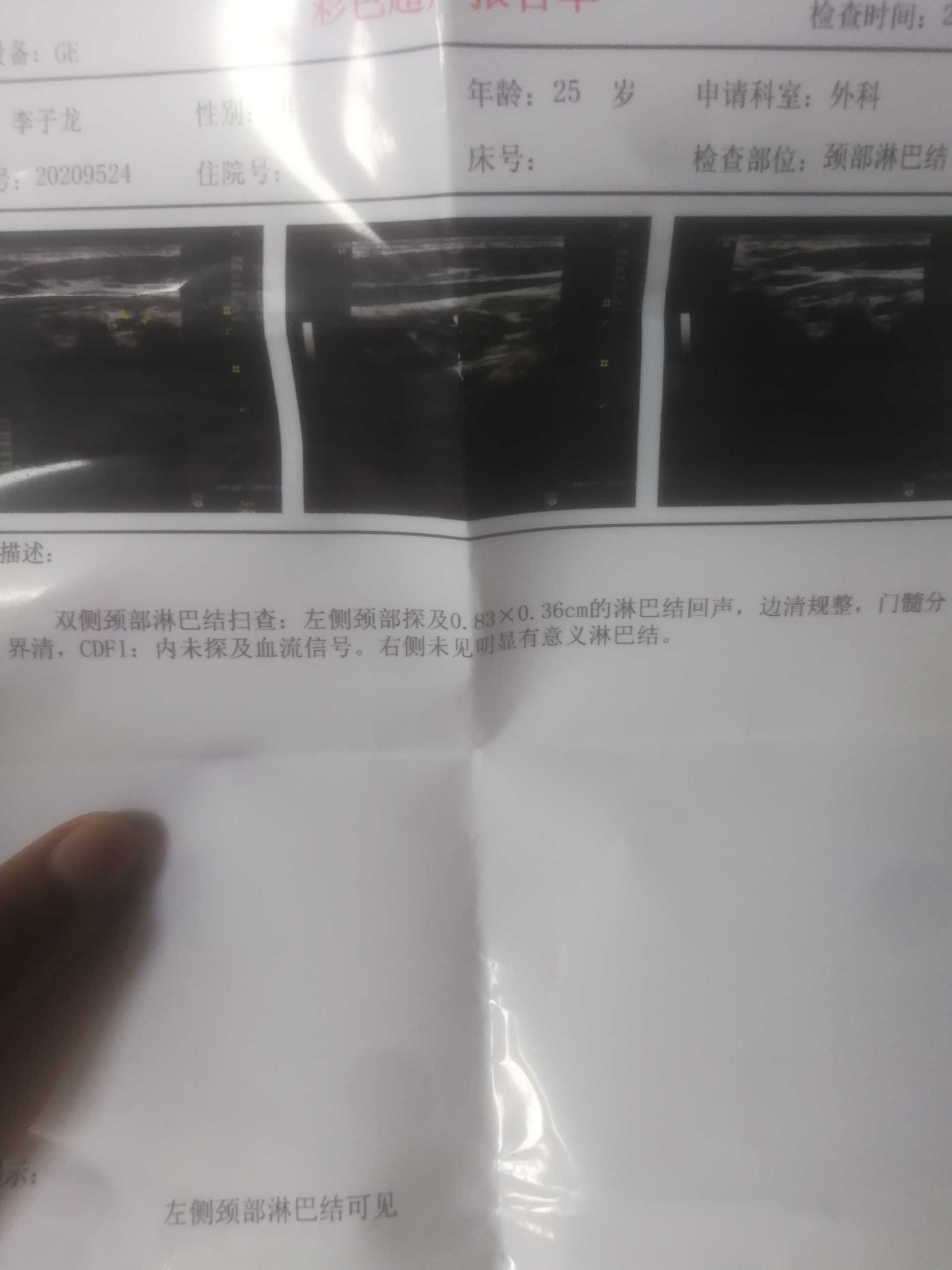220555yi5d372bh5mooouy.jpg