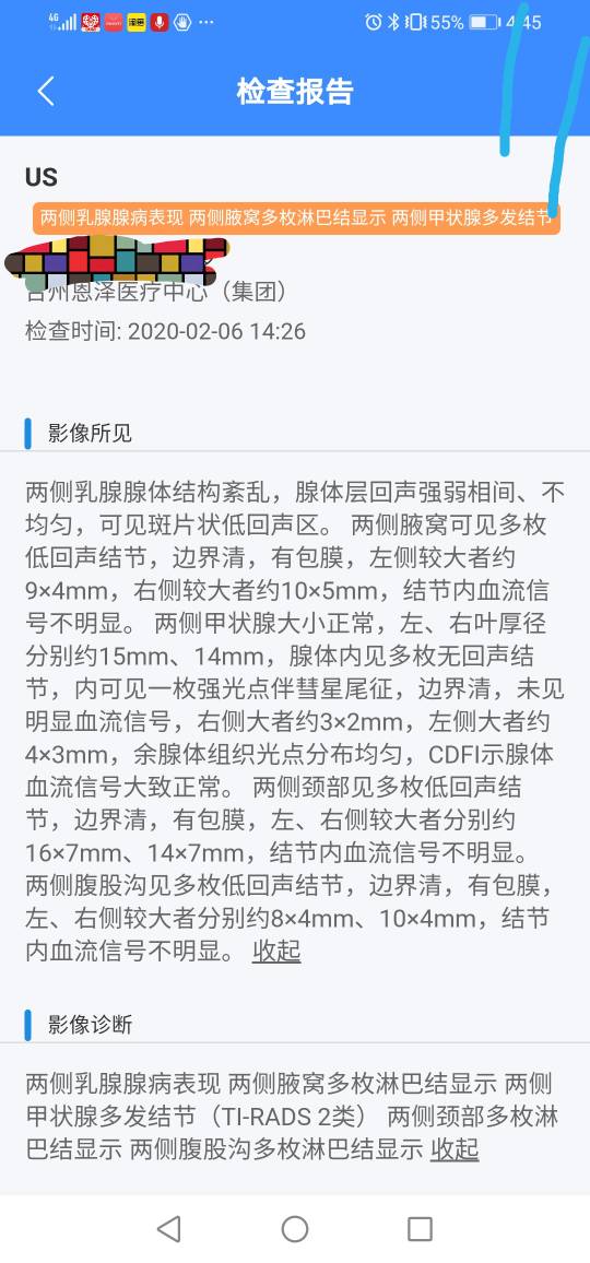 170655hgjqttfv1musmgex.jpg