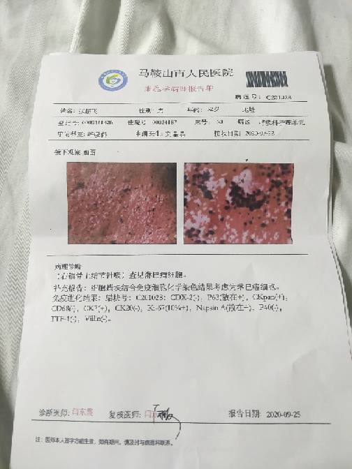 150256pl7449cm1g7lhygt.jpg