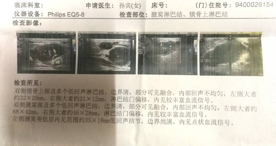 110229aeel3tqxad5iumi4.jpg