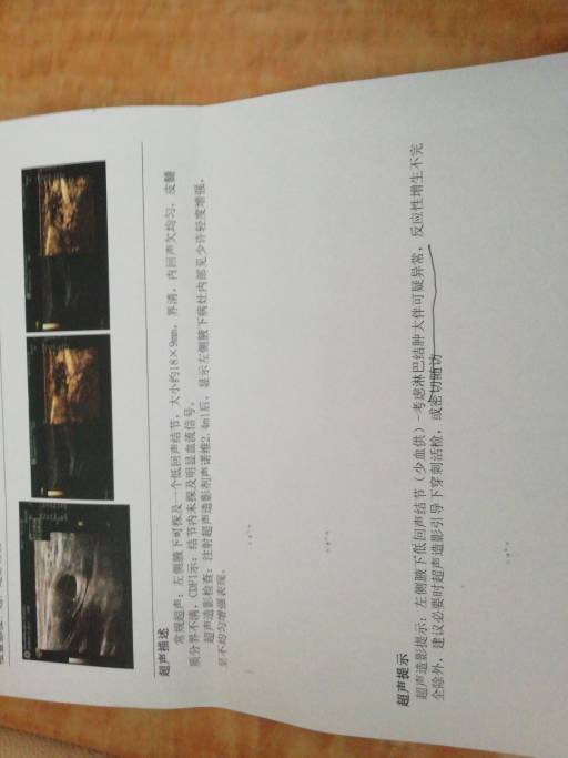 203835cer7cmmcee835azk.jpg