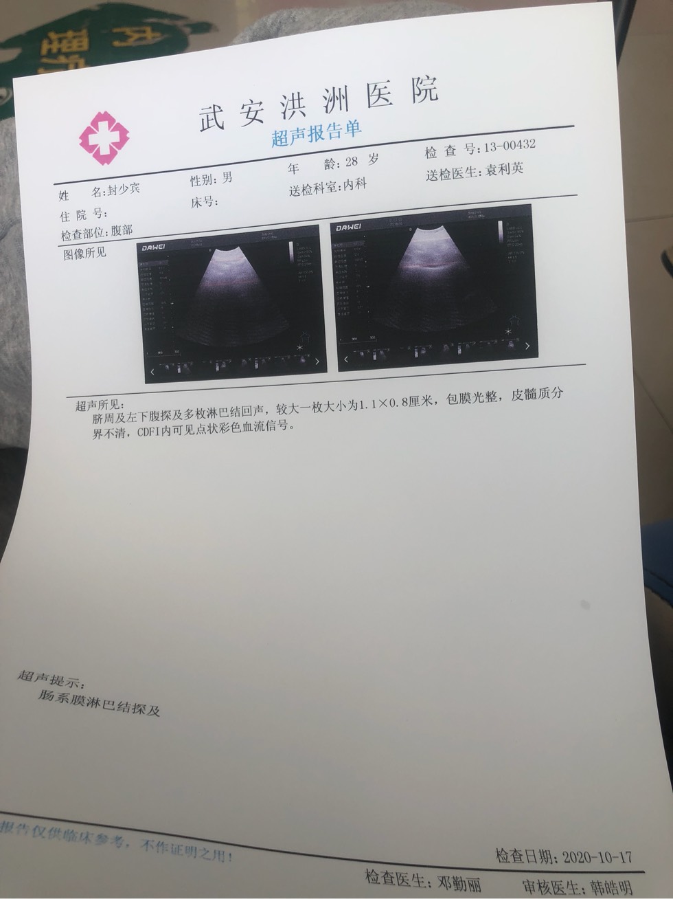 172149xch2ep34cpfznwef.jpg