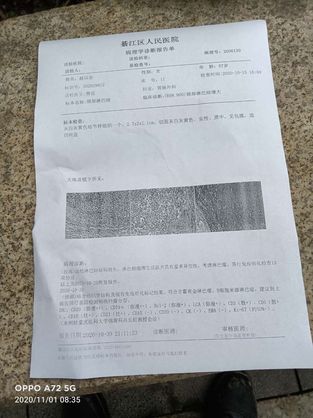 122648cudz7hknei9sedvu.jpg